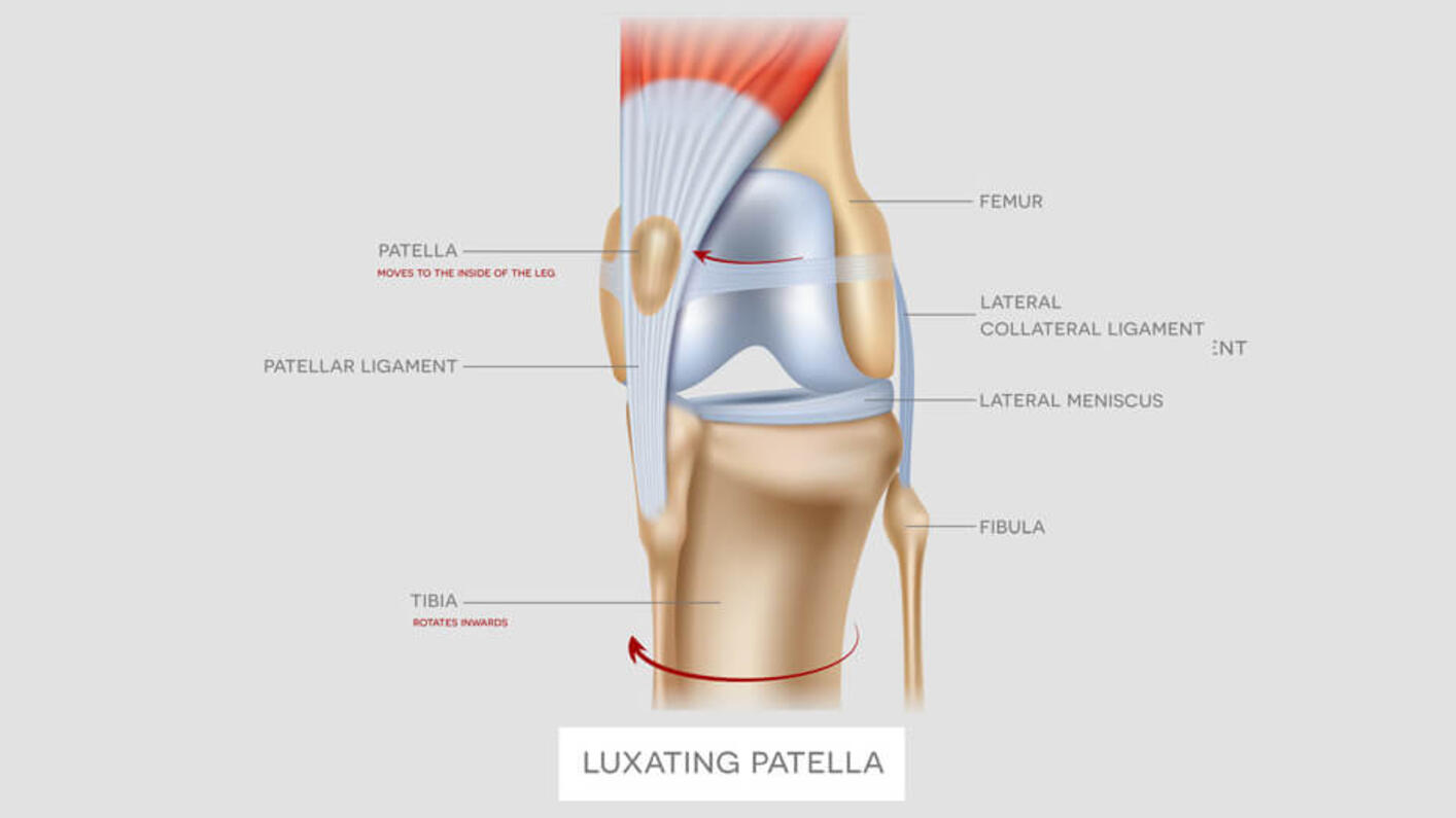 Luxating Patella